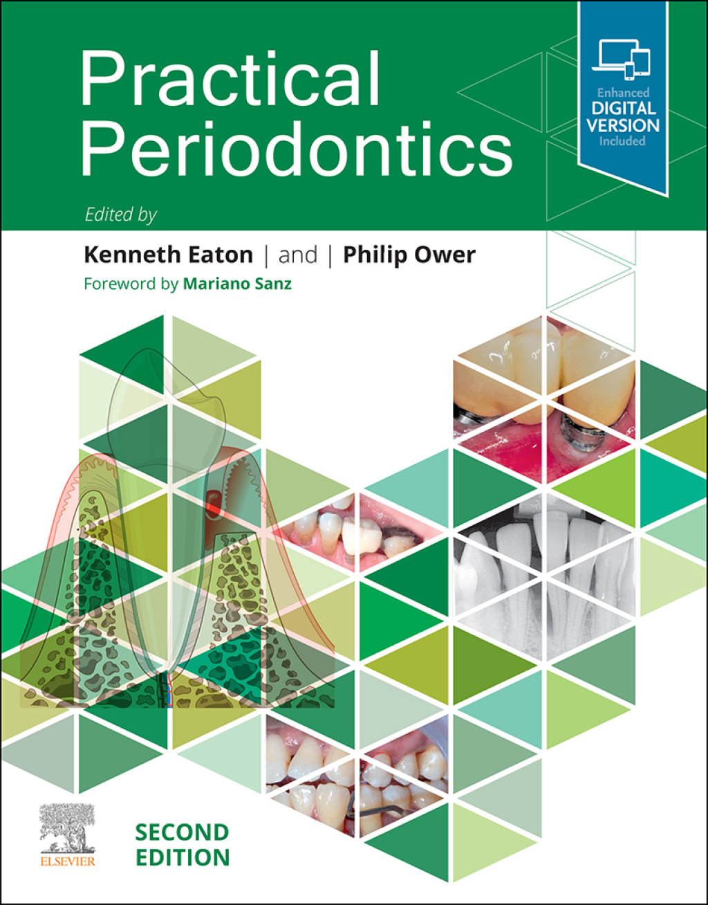 Practical Periodontics 2nd Edition â€“ PDF/EPUB Version Downloadable