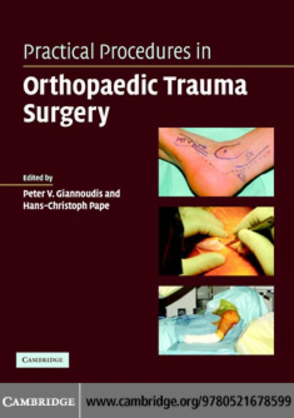 Practical Procedures in Orthopaedic Trauma Surgery 1st Edition â€“ PDF/EPUB Version Downloadable
