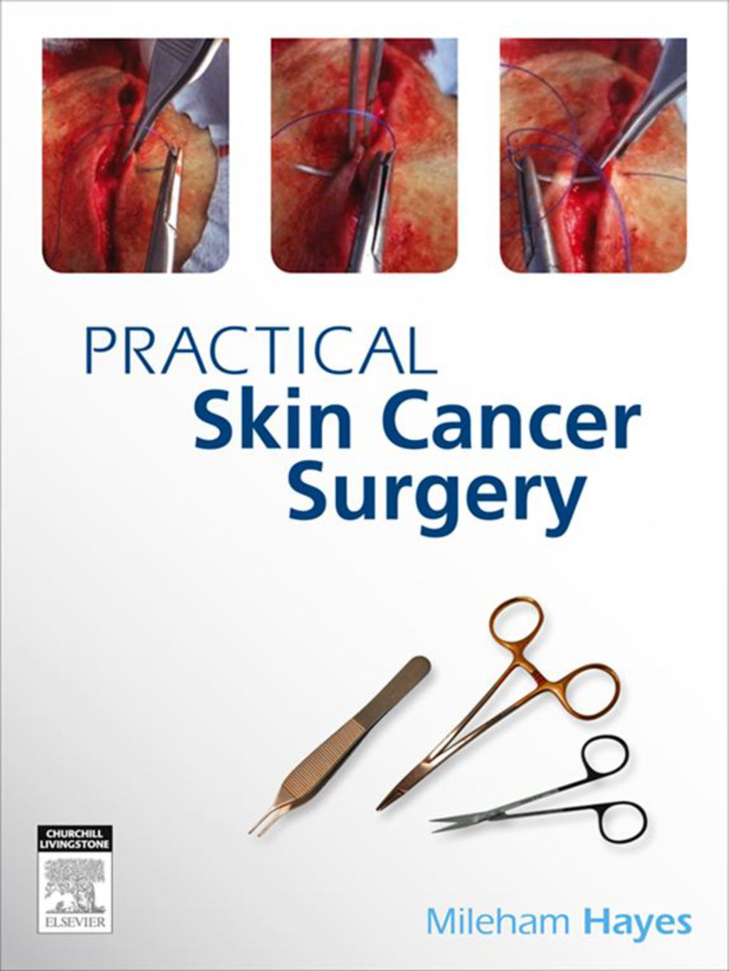Practical Skin Cancer Surgery 1st Edition â€“ PDF/EPUB Version Downloadable