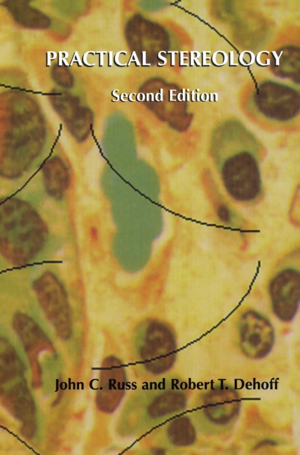 Practical Stereology 2nd Edition â€“ PDF/EPUB Version Downloadable