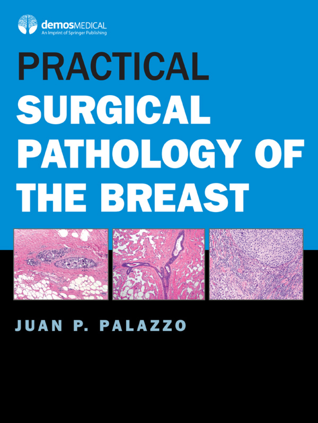 Practical Surgical Pathology of the Breast 1st Edition â€“ PDF/EPUB Version Downloadable