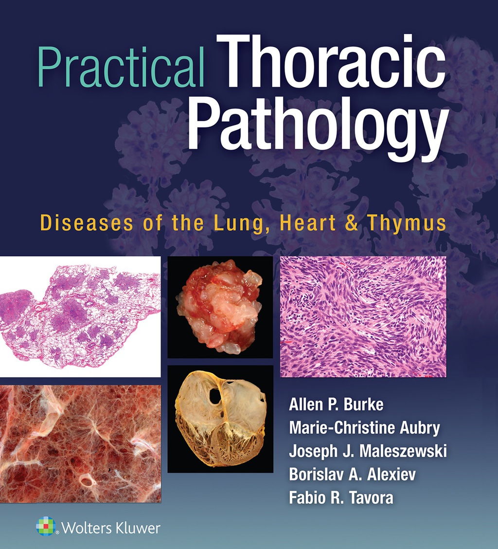 Practical Thoracic Pathology Diseases of the Lung, Heart, and Thymus  â€“ PDF/EPUB Version Downloadable