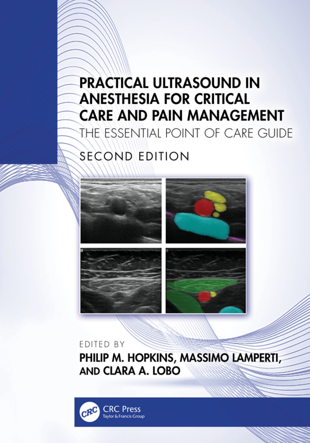 Practical Ultrasound in Anesthesia for Critical Care and Pain Management The Essential Point of Care Guide 2nd Edition â€“ PDF/EPUB Version Downloadable