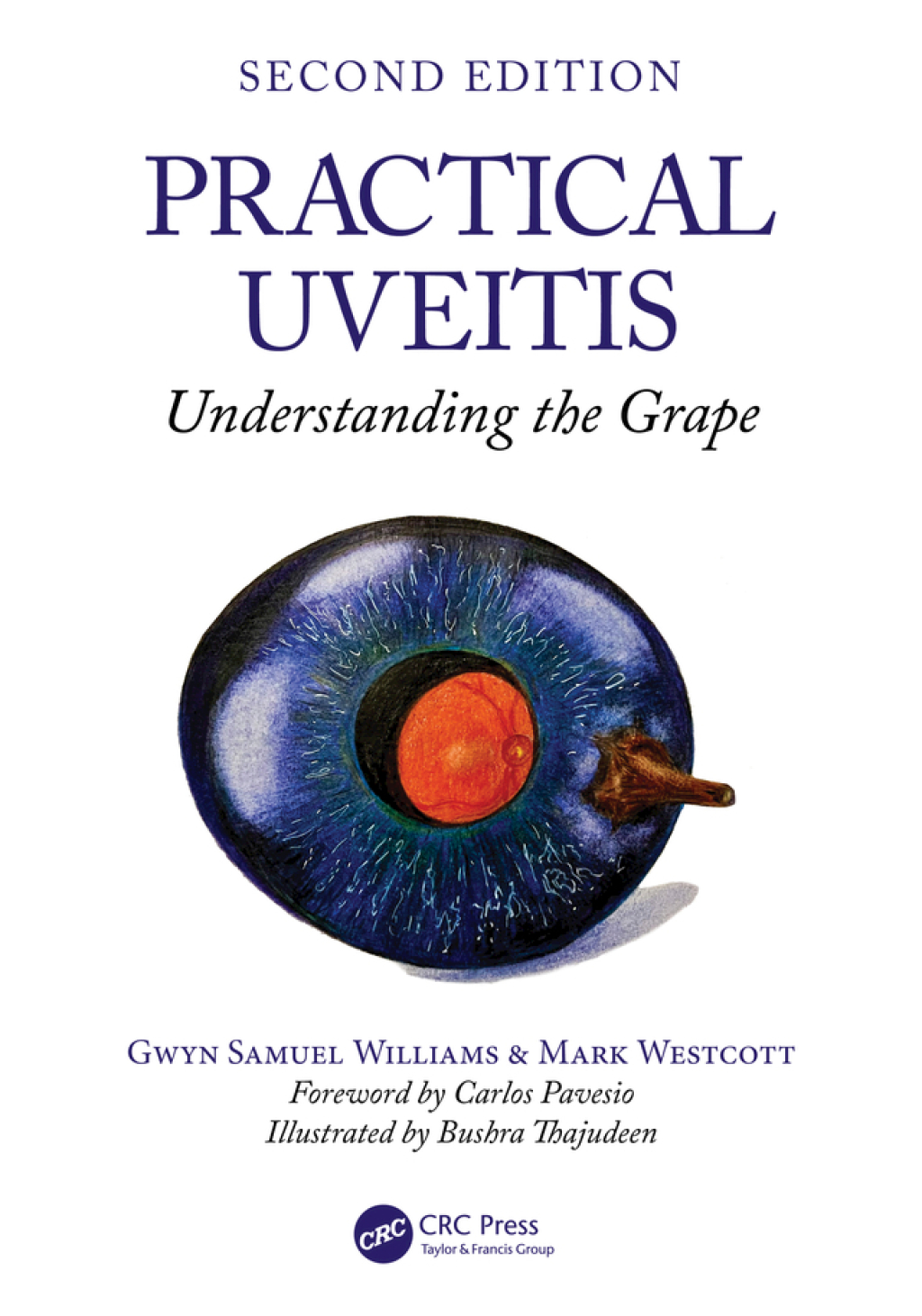 Practical Uveitis Understanding the Grape 2nd Edition â€“ PDF/EPUB Version Downloadable