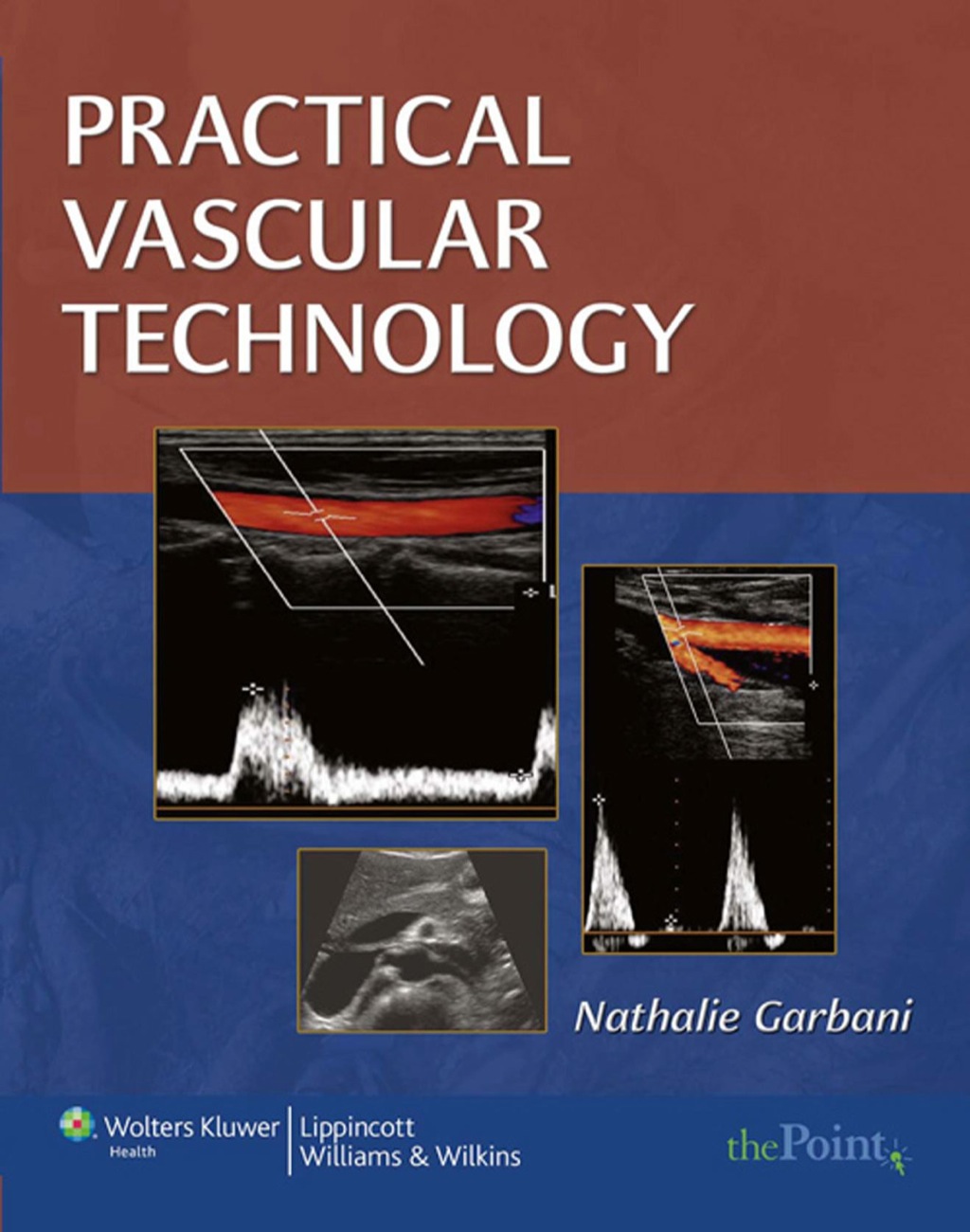Practical Vascular Technology 1st Edition â€“ PDF/EPUB Version Downloadable