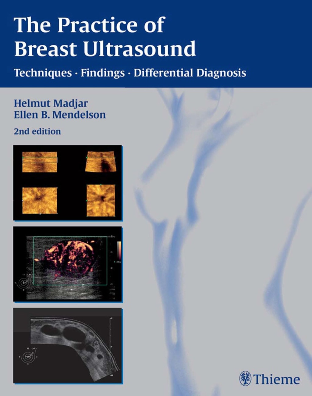 Practice of Breast Ultrasound: Techniques, Findings, Differential Diagnosis 2nd Edition â€“ PDF/EPUB Version Downloadable