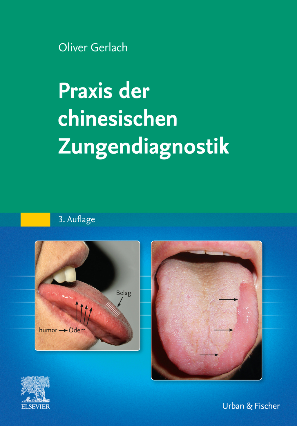 Praxis der chinesischen Zungendiagnostik 3rd Edition â€“ PDF/EPUB Version Downloadable