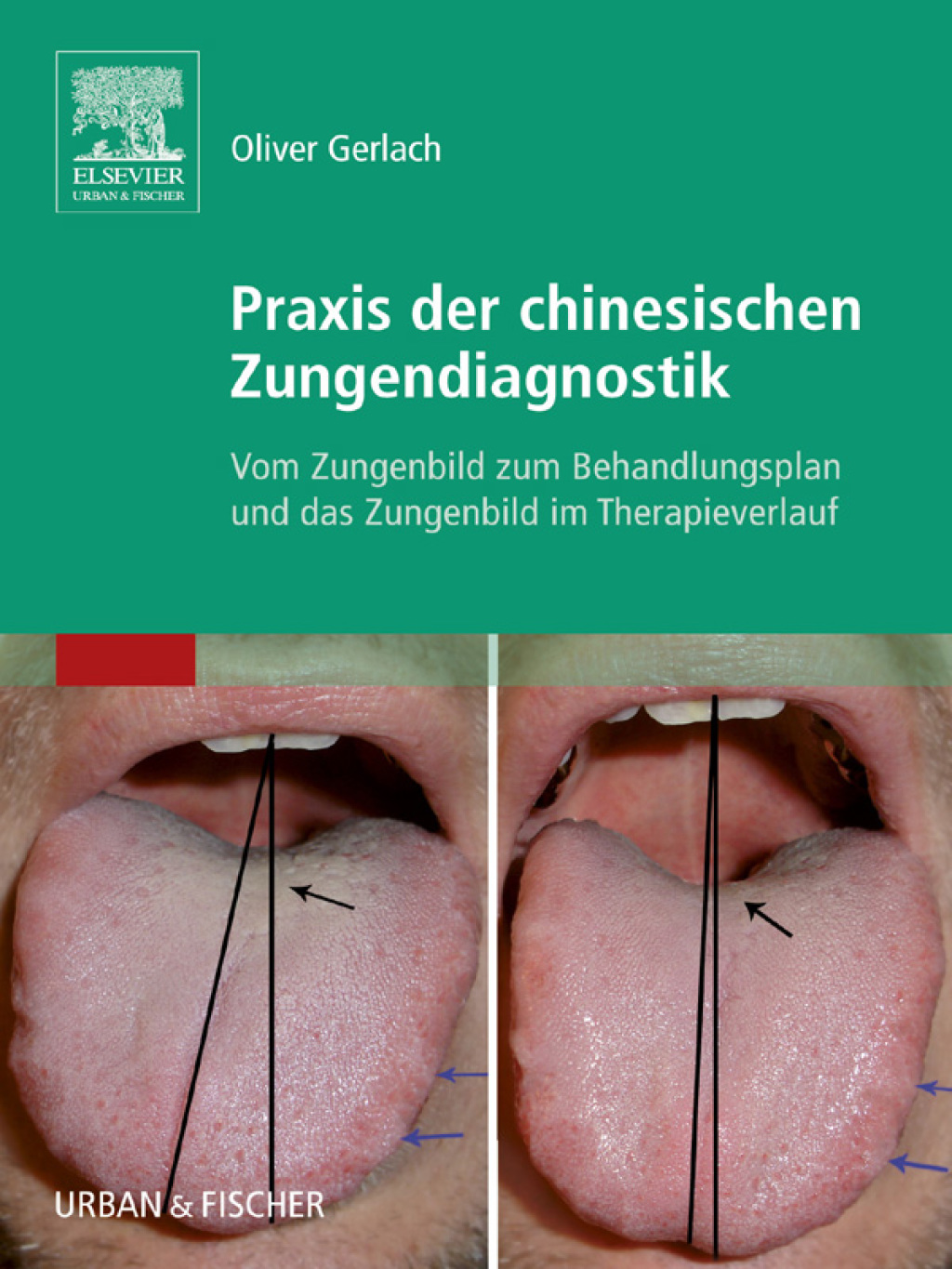 Praxis der chinesischen Zungendiagnostik Vom Zungenbild zum Behandlungsplan und das Zungenbild im Therapieverlauf  â€“ PDF/EPUB Version Downloadable