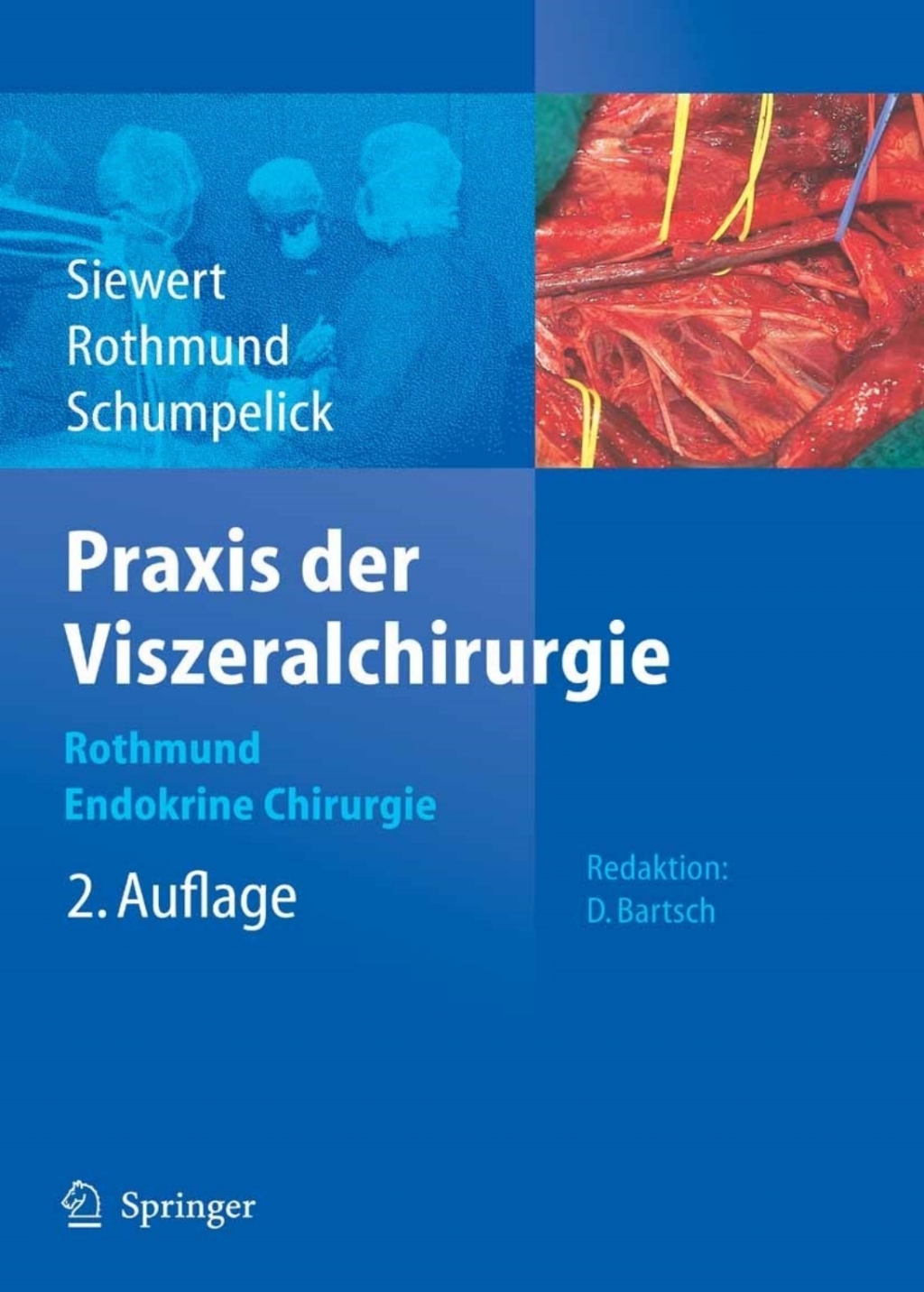 Praxis der Viszeralchirurgie Endokrine Chirurgie 2nd Edition â€“ PDF/EPUB Version Downloadable