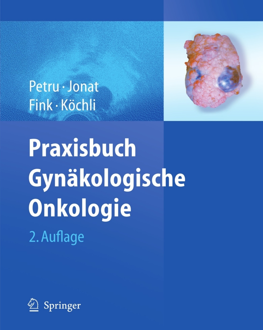 Praxisbuch GynÃ¤kologische Onkologie 2nd Edition â€“ PDF/EPUB Version Downloadable