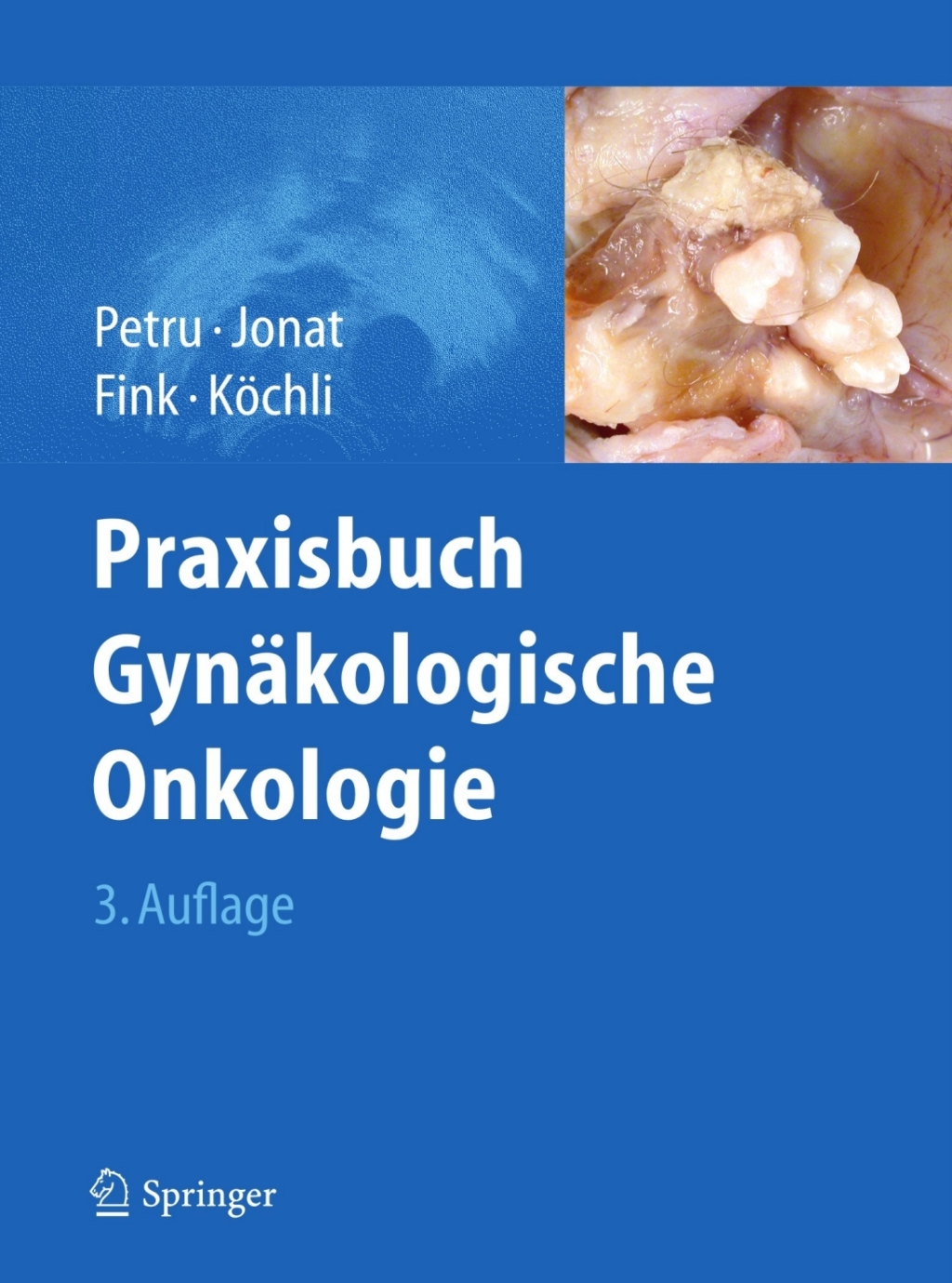 Praxisbuch GynÃ¤kologische Onkologie 3rd Edition â€“ PDF/EPUB Version Downloadable