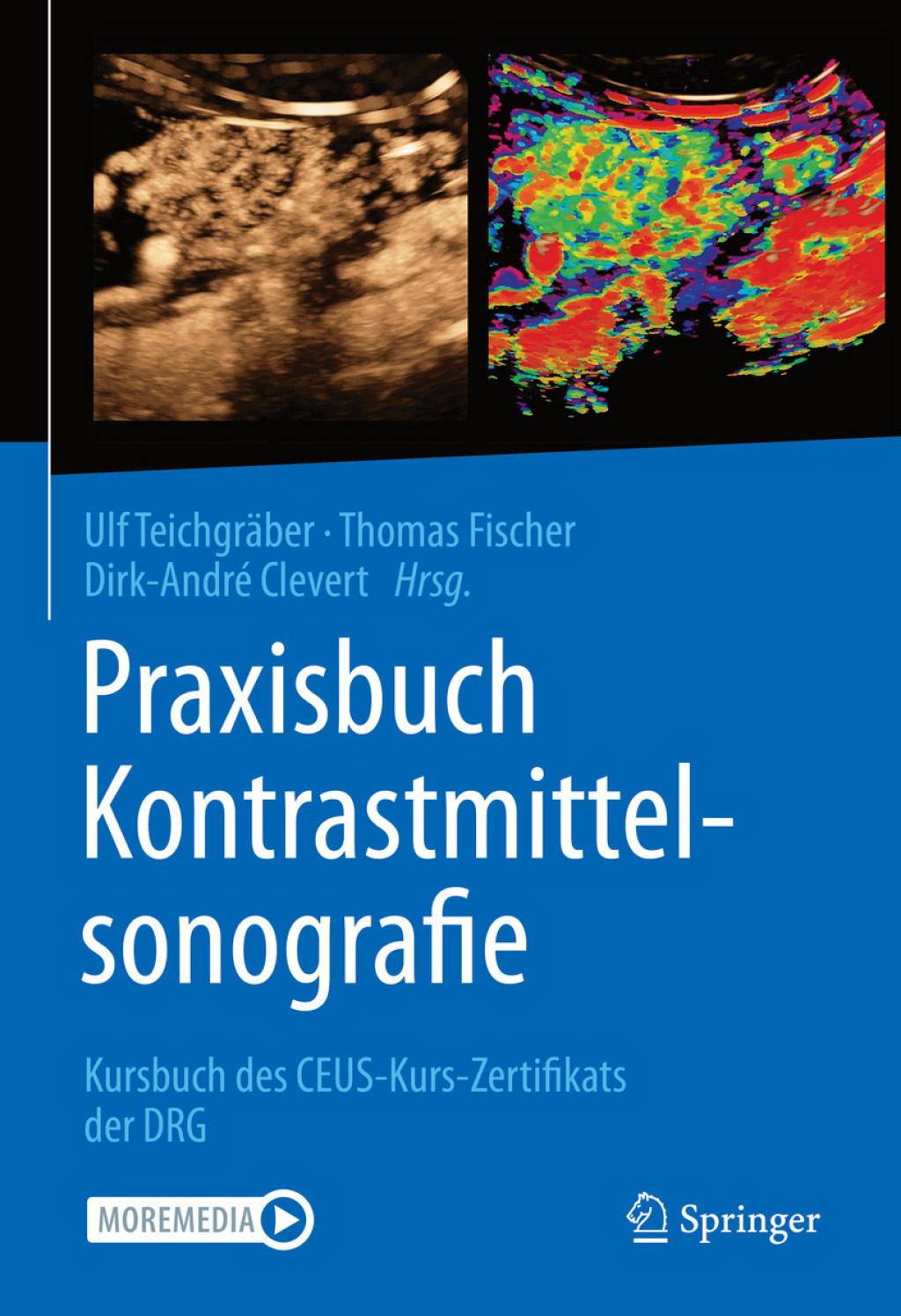 Praxisbuch Kontrastmittelsonografie Kursbuch des CEUS-Kurs-Zertifikats der DRG  â€“ PDF/EPUB Version Downloadable