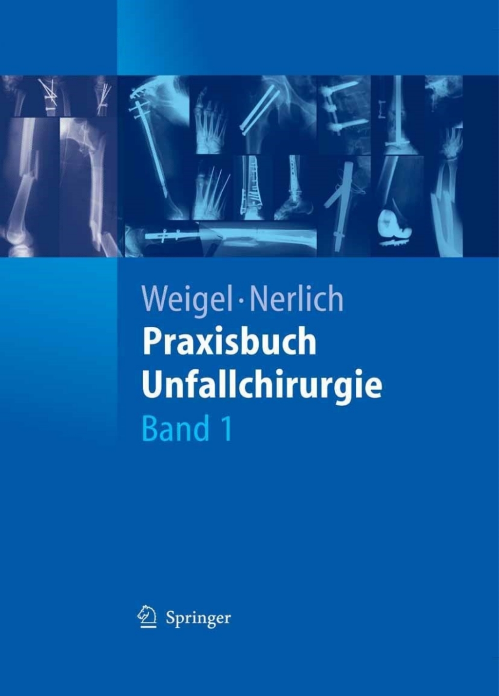 Praxisbuch Unfallchirurgie 1st Edition â€“ PDF/EPUB Version Downloadable