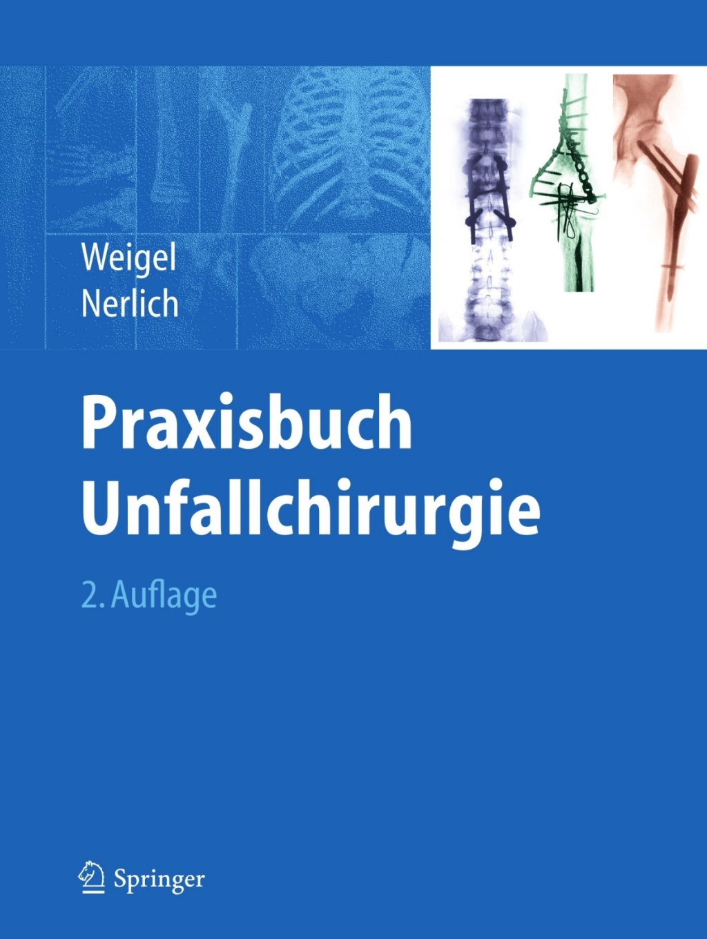 Praxisbuch Unfallchirurgie 2nd Edition â€“ PDF/EPUB Version Downloadable