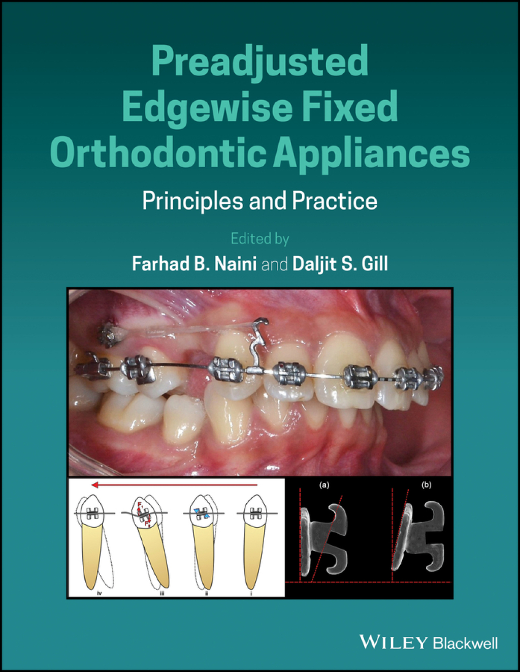 Preadjusted Edgewise Fixed Orthodontic Appliances Principles and Practice 1st Edition â€“ PDF/EPUB Version Downloadable