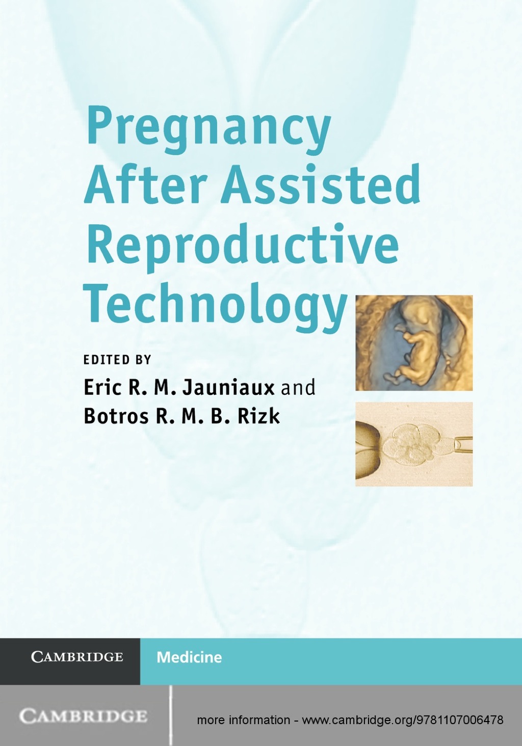 Pregnancy After Assisted Reproductive Technology 1st Edition â€“ PDF/EPUB Version Downloadable