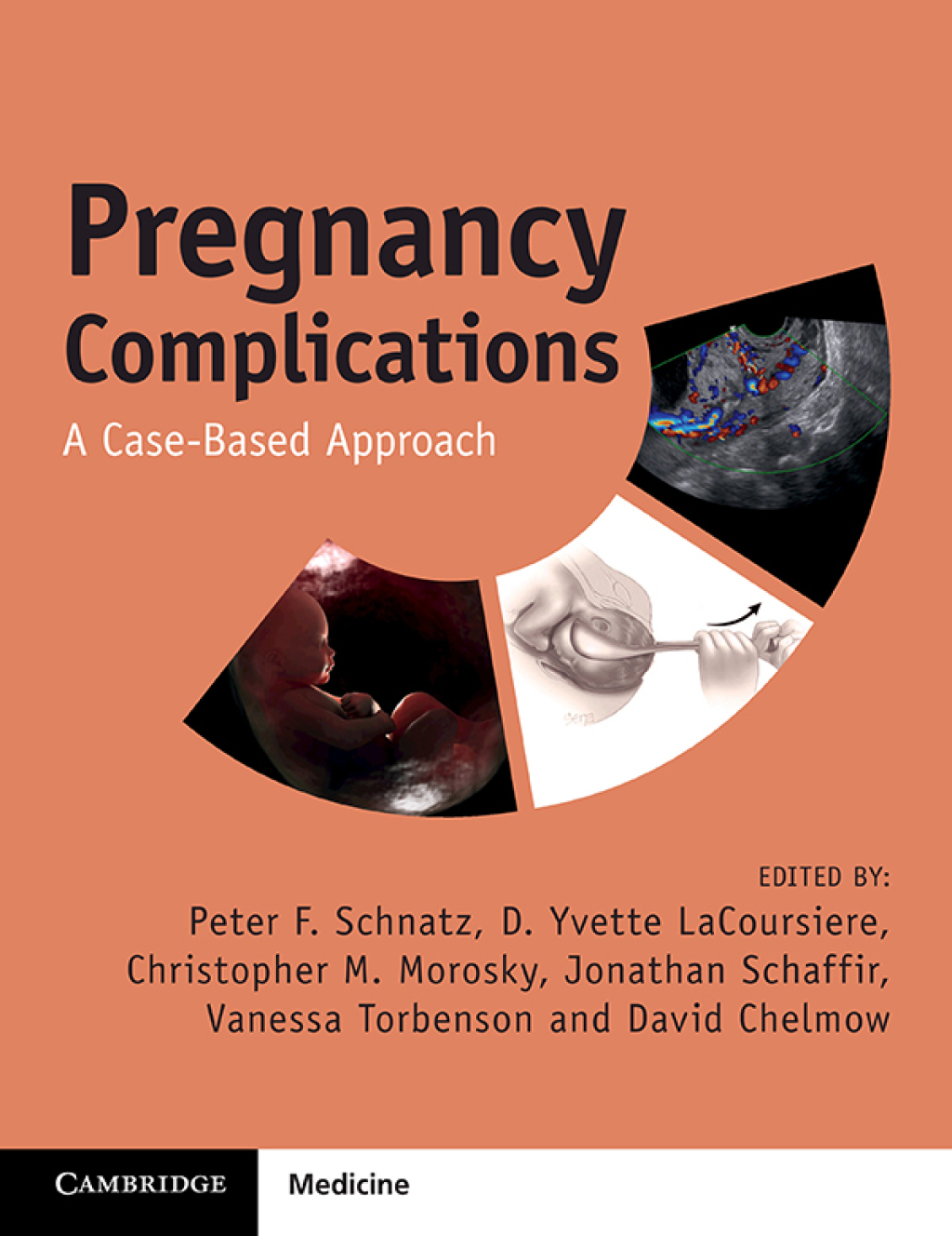 Pregnancy Complications A Case-Based Approach  â€“ PDF/EPUB Version Downloadable