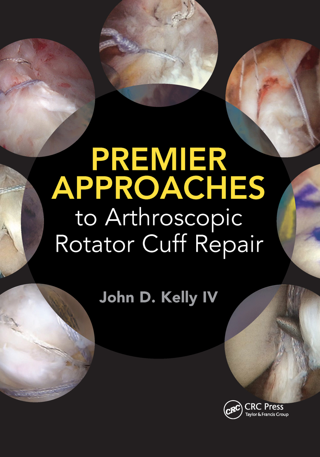 Premier Approaches to Arthroscopic Rotator Cuff Repair 1st Edition â€“ PDF/EPUB Version Downloadable
