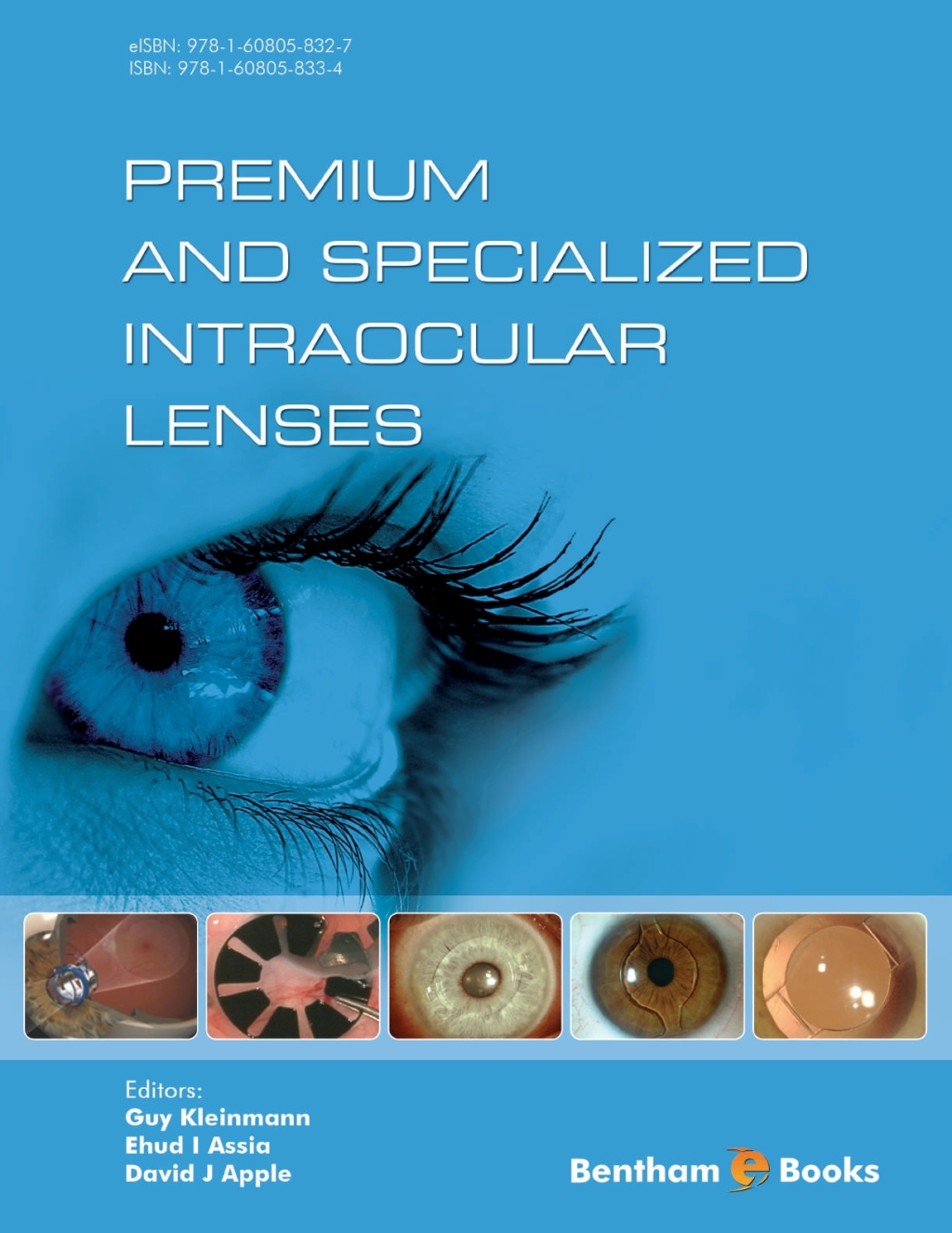 Premium and Specialized Intraocular Lenses 1st Edition â€“ PDF/EPUB Version Downloadable