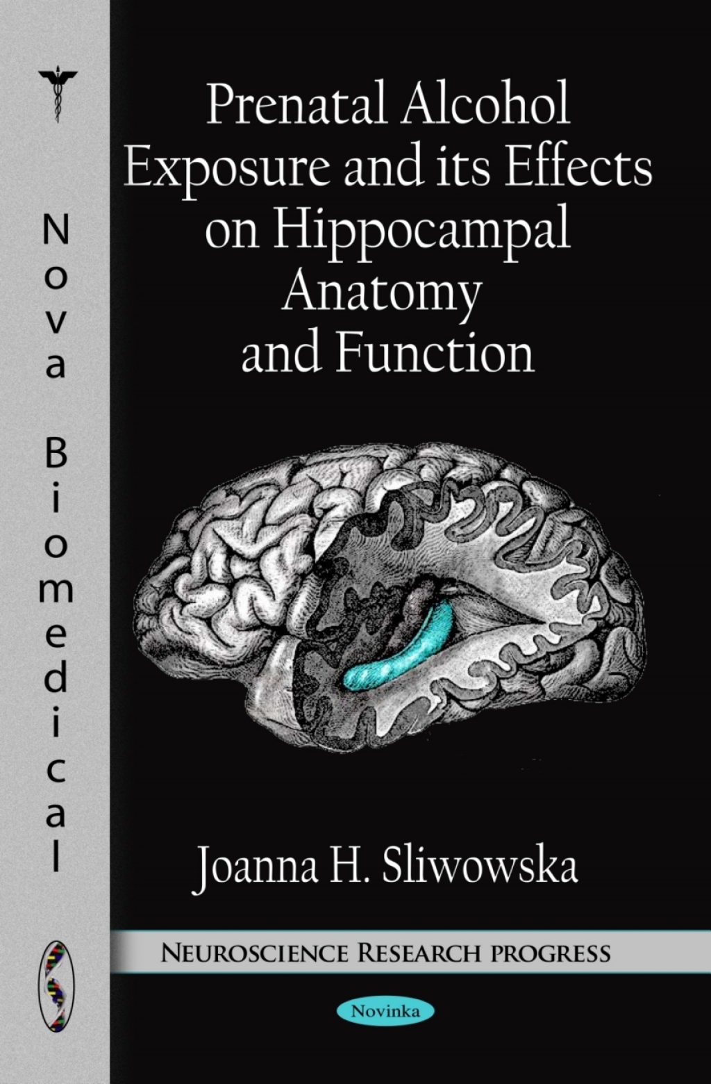 Prenatal Alcohol Exposure and its Effects on Hippocampal Anatomy and Function  â€“ PDF/EPUB Version Downloadable