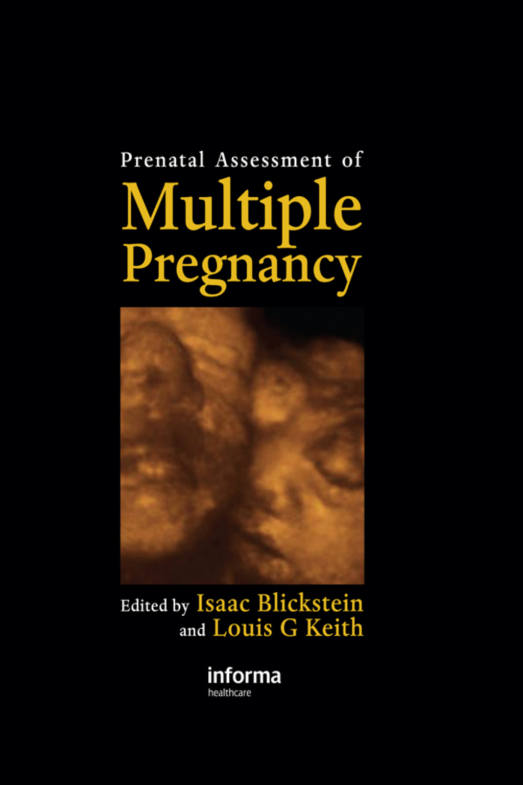 Prenatal Assessment of Multiple Pregnancy 1st Edition â€“ PDF/EPUB Version Downloadable