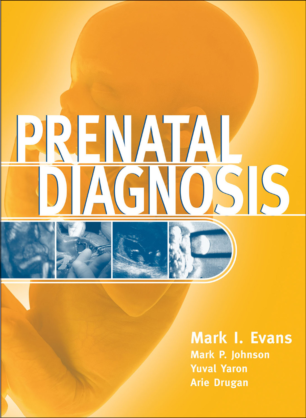 Prenatal Diagnosis 1st Edition â€“ PDF/EPUB Version Downloadable