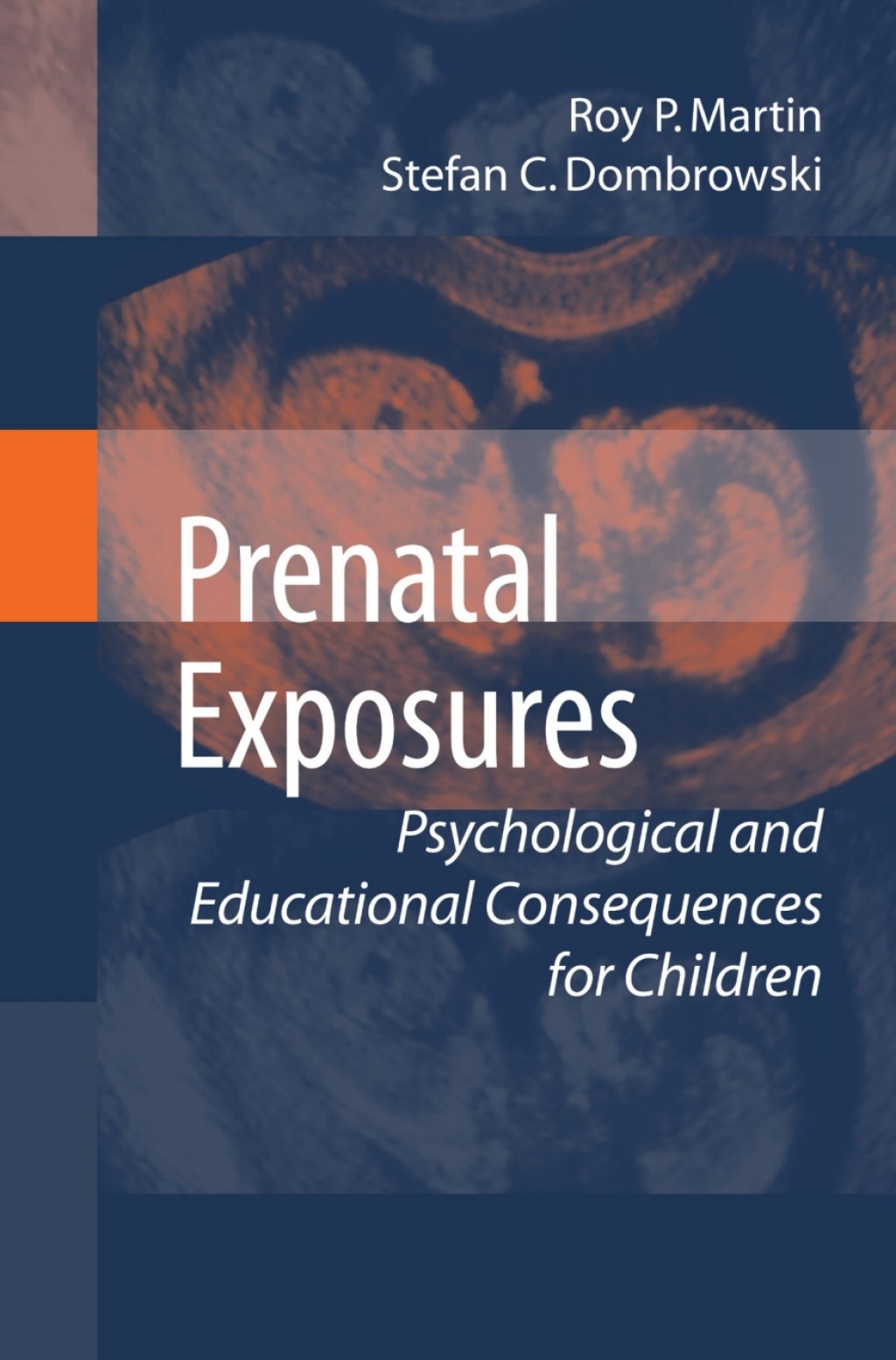 Prenatal Exposures Psychological and Educational Consequences for Children  â€“ PDF/EPUB Version Downloadable