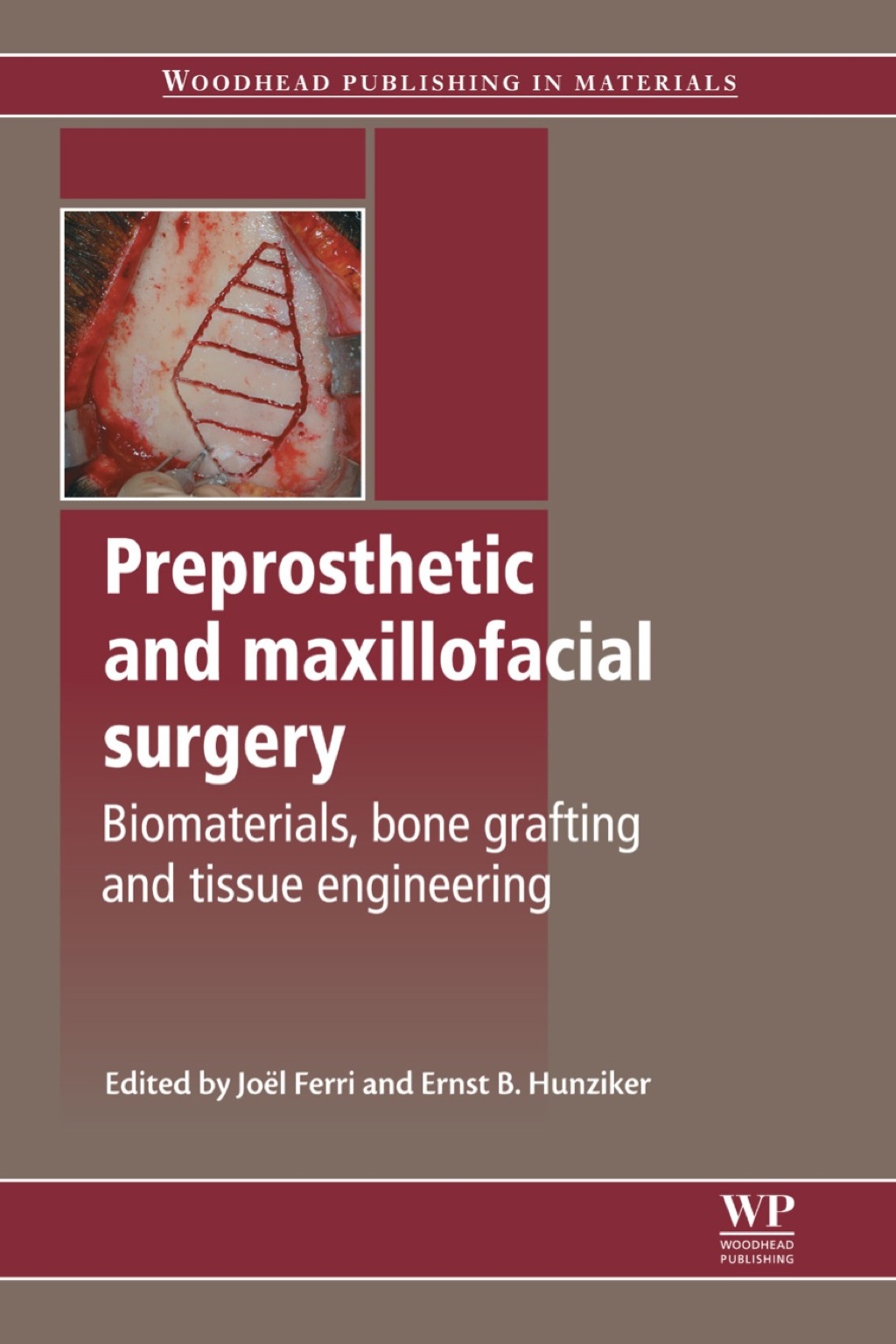 Preprosthetic and Maxillofacial Surgery: Biomaterials, Bone Grafting and Tissue Engineering  â€“ PDF/EPUB Version Downloadable