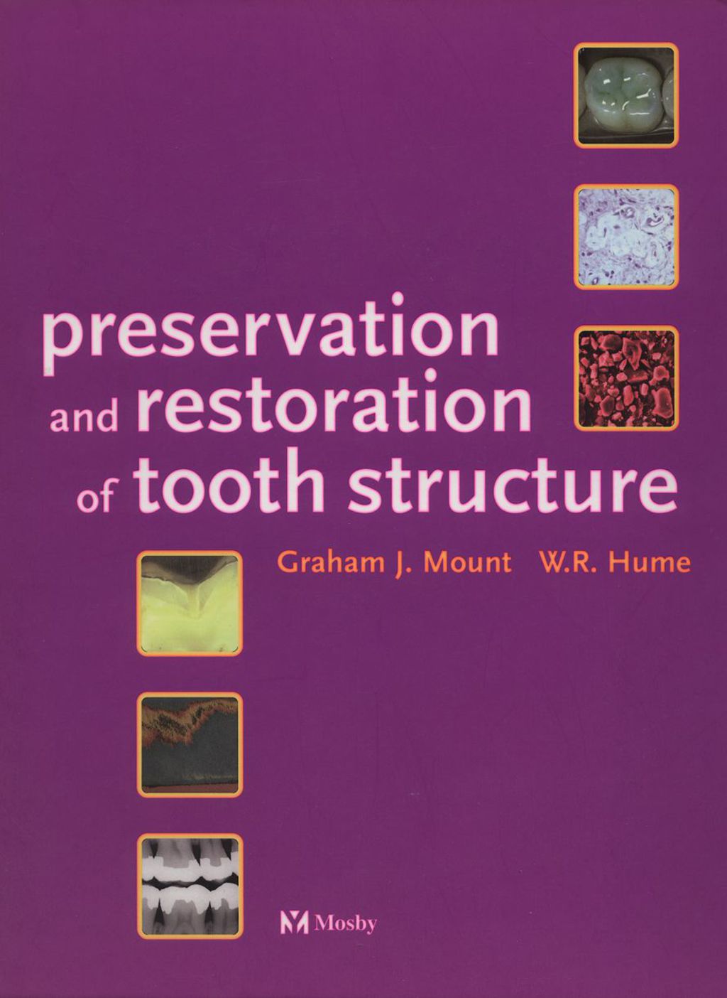 Preservation & Restoration of Tooth Structure 1st Edition â€“ PDF/EPUB Version Downloadable