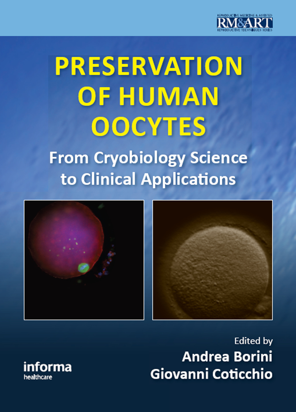 Preservation of Human Oocytes From Cryobiology Science to Clinical Applications 1st Edition â€“ PDF/EPUB Version Downloadable