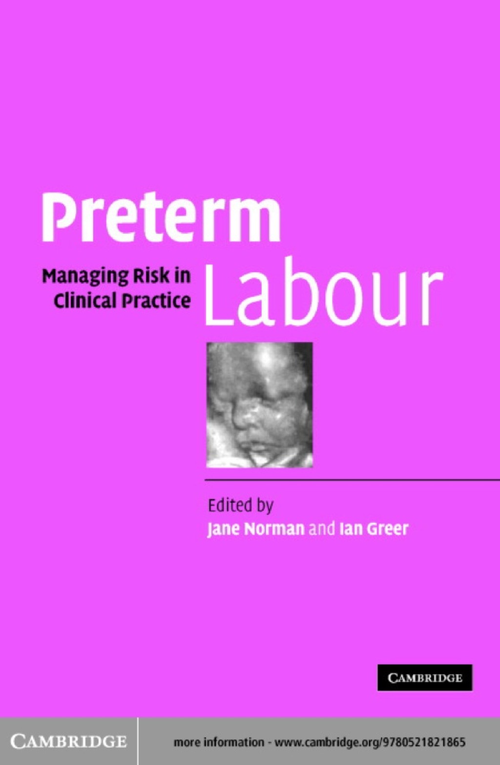 Preterm Labour Managing Risk in Clinical Practice 1st Edition â€“ PDF/EPUB Version Downloadable
