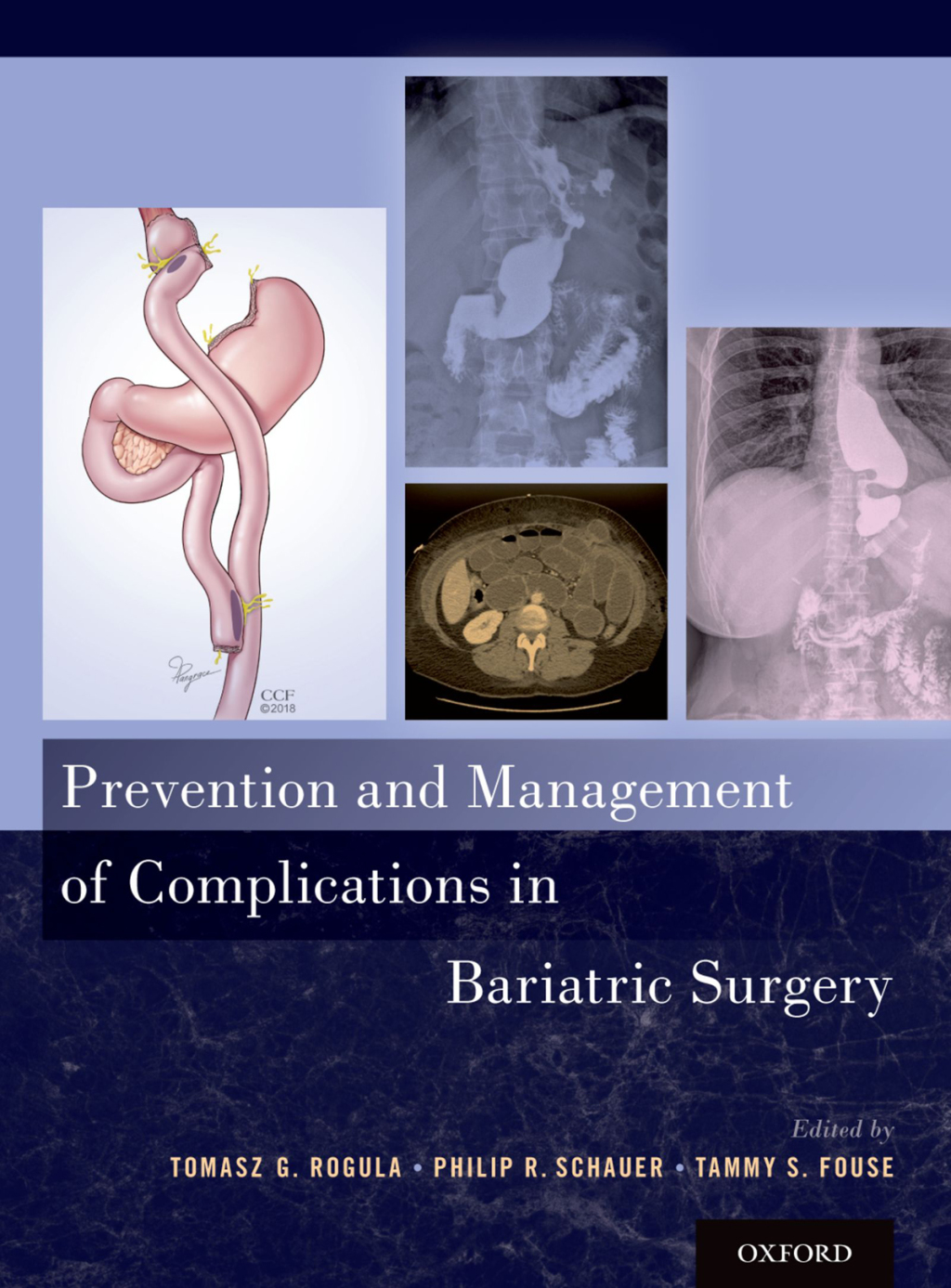 Prevention and Management of Complications in Bariatric Surgery 1st Edition â€“ PDF/EPUB Version Downloadable