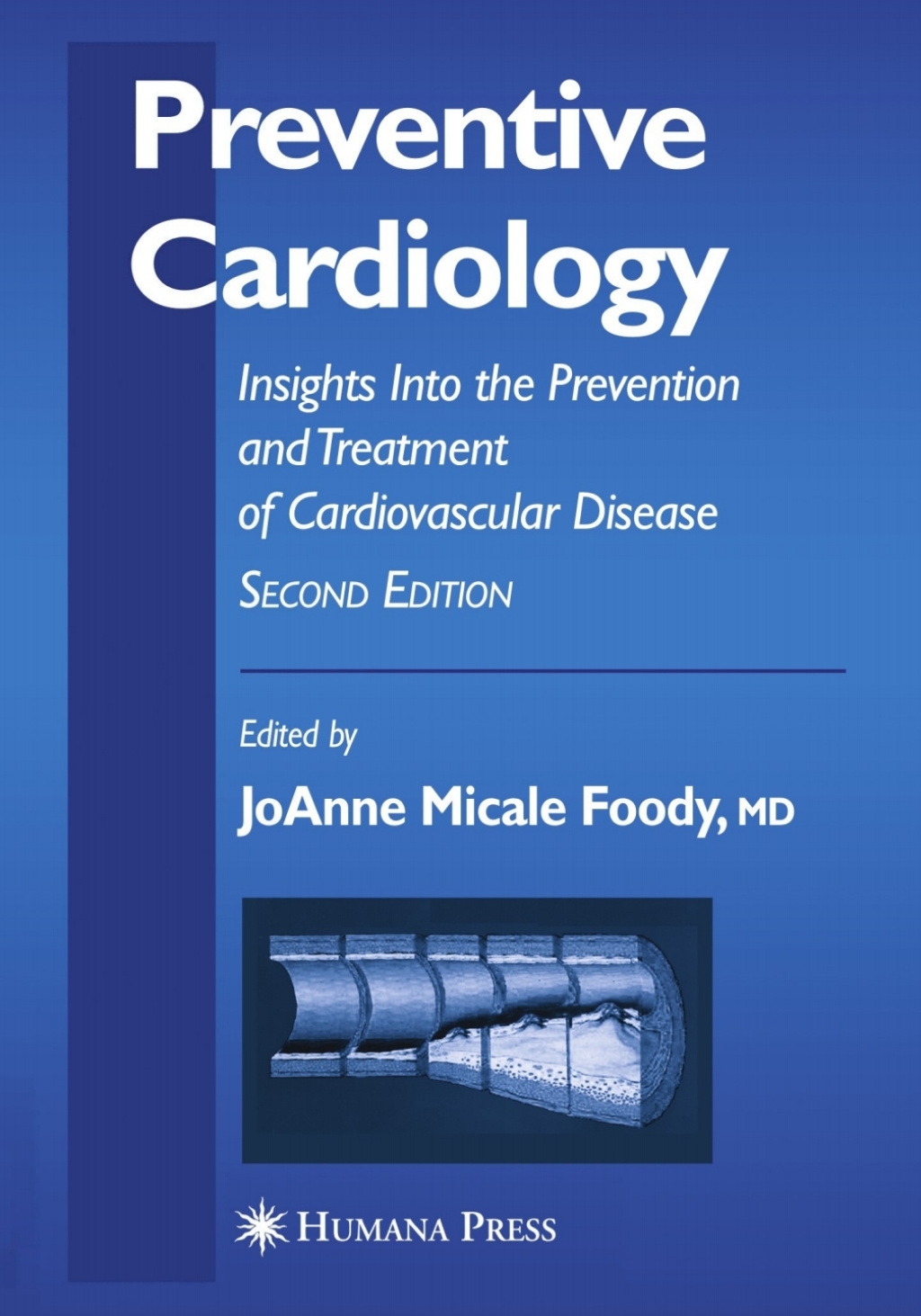 Preventive Cardiology Insights Into the Prevention and Treatment of Cardiovascular Disease 2nd Edition â€“ PDF/EPUB Version Downloadable
