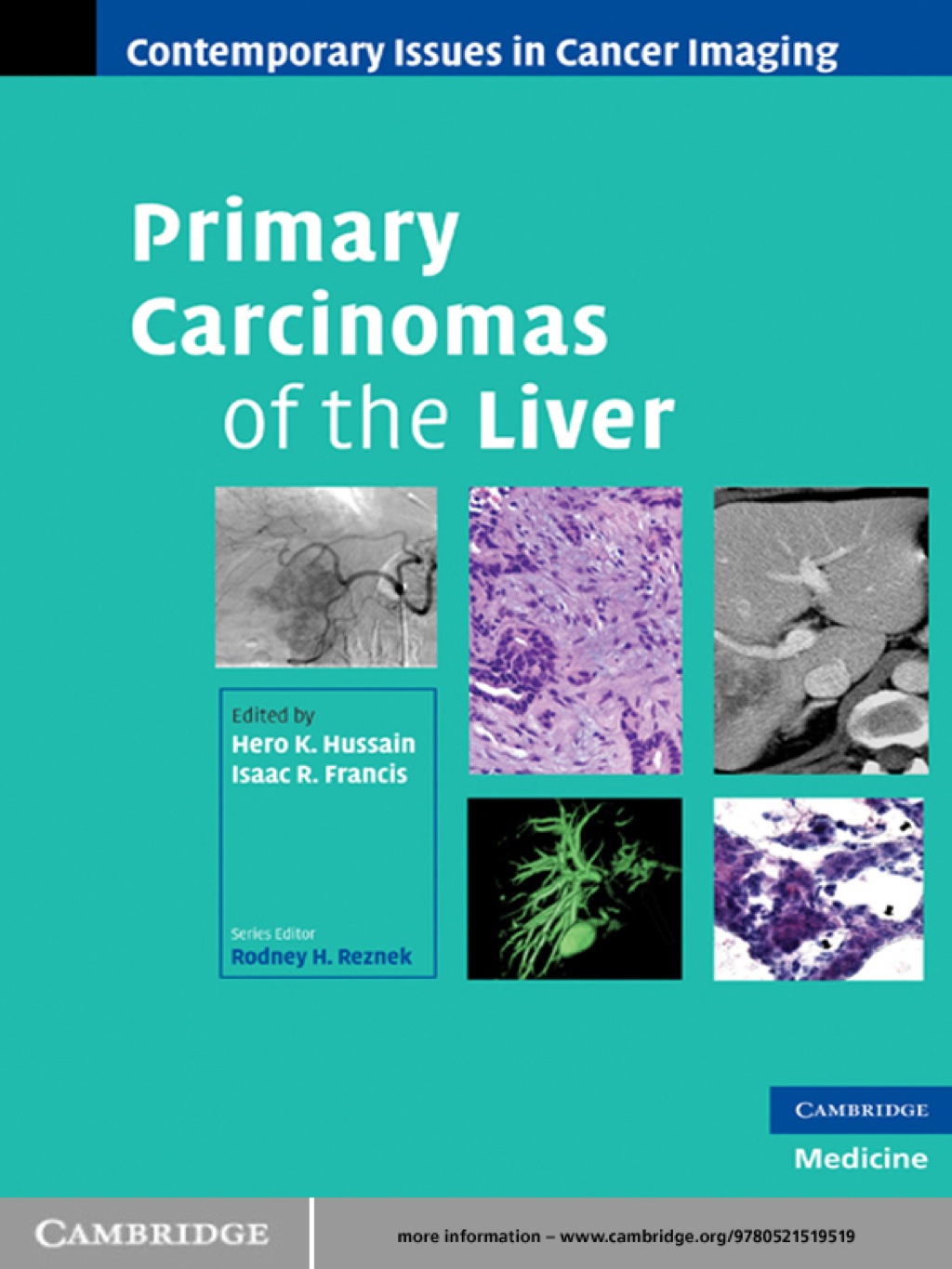 Primary Carcinomas of the Liver 1st Edition â€“ PDF/EPUB Version Downloadable