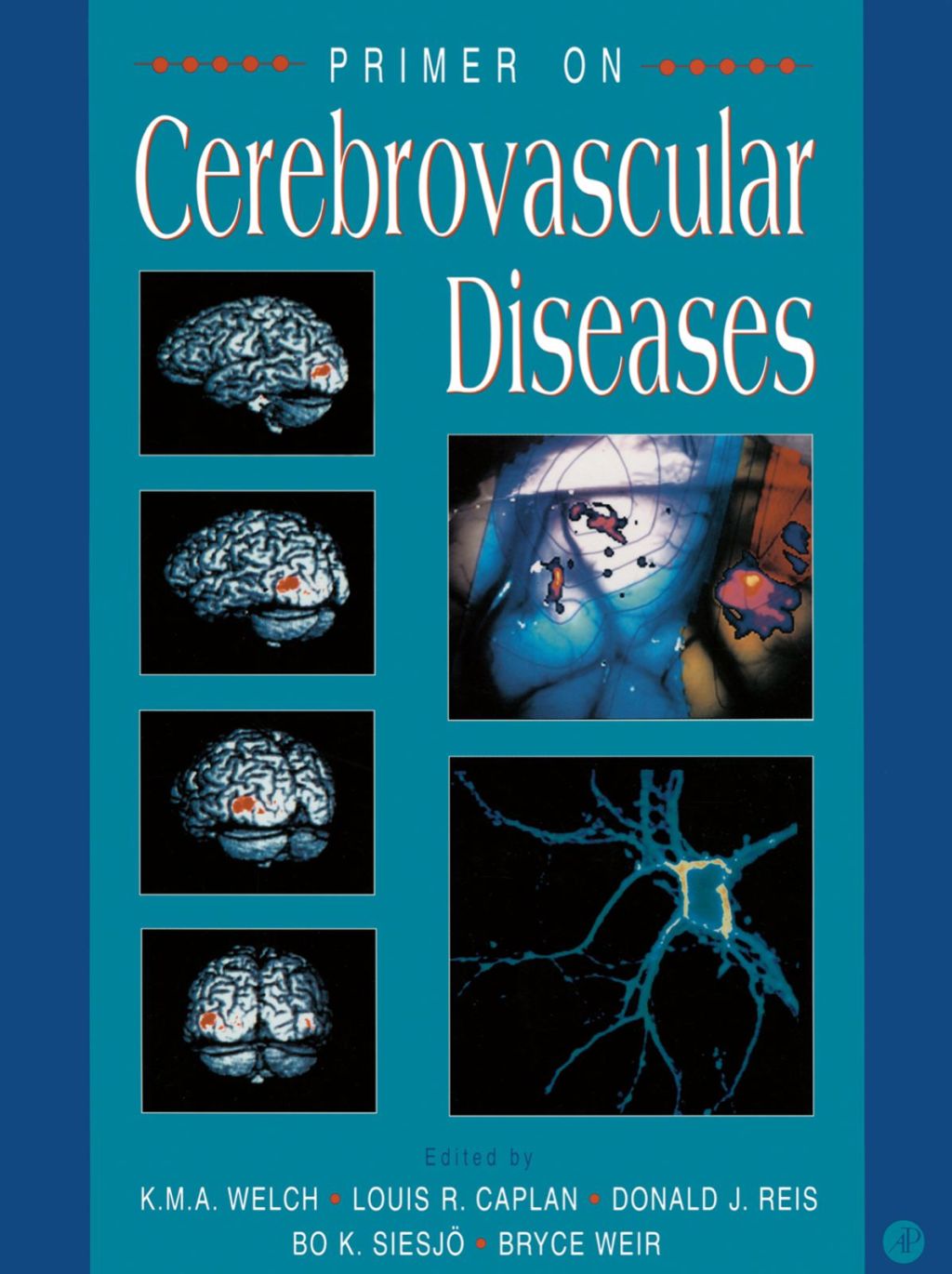 Primer on Cerebrovascular Diseases  â€“ PDF/EPUB Version Downloadable