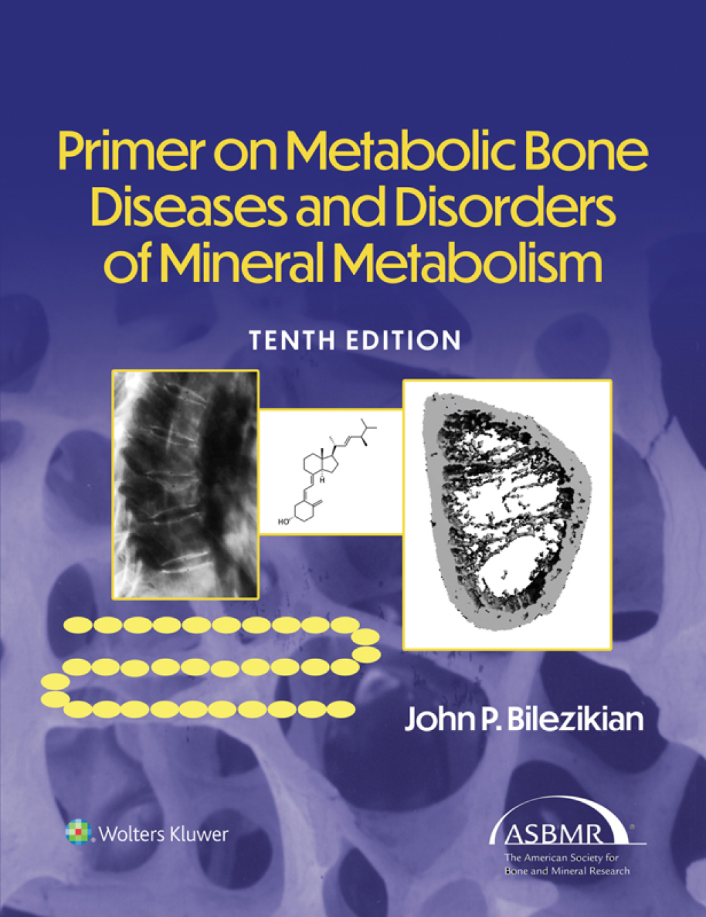 Primer on the Metabolic Bone Diseases and Disorders of Mineral Metabolism 10th Edition â€“ PDF/EPUB Version Downloadable