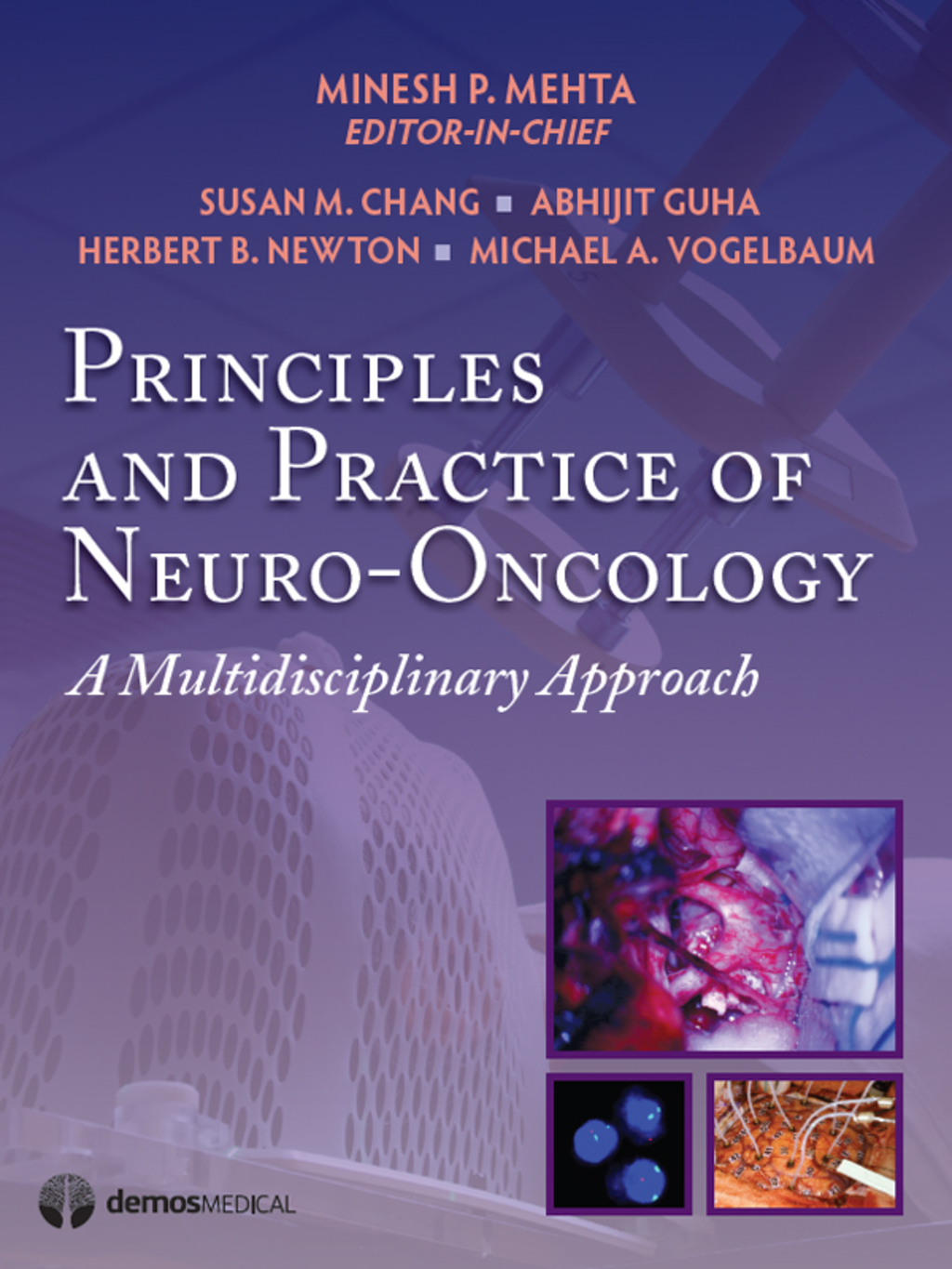 Principles & Practice of Neuro-Oncology A Multidisciplinary Approach 1st Edition â€“ PDF/EPUB Version Downloadable