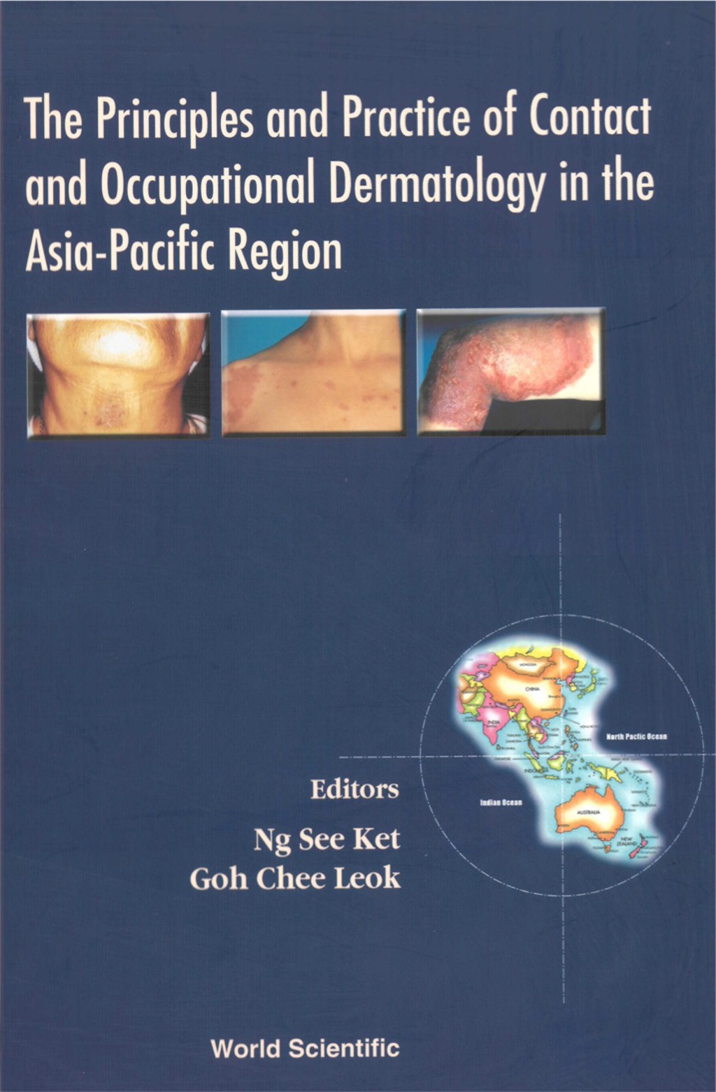 Principles And Practice Of Contact And Occupational Dermatology In The Asia-pacific Region, The 1st Edition â€“ PDF/EPUB Version Downloadable