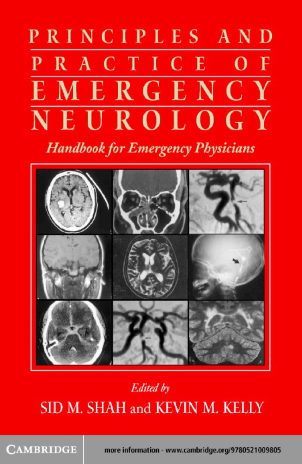 Principles and Practice of Emergency Neurology Handbook for Emergency Physicians 1st Edition â€“ PDF/EPUB Version Downloadable