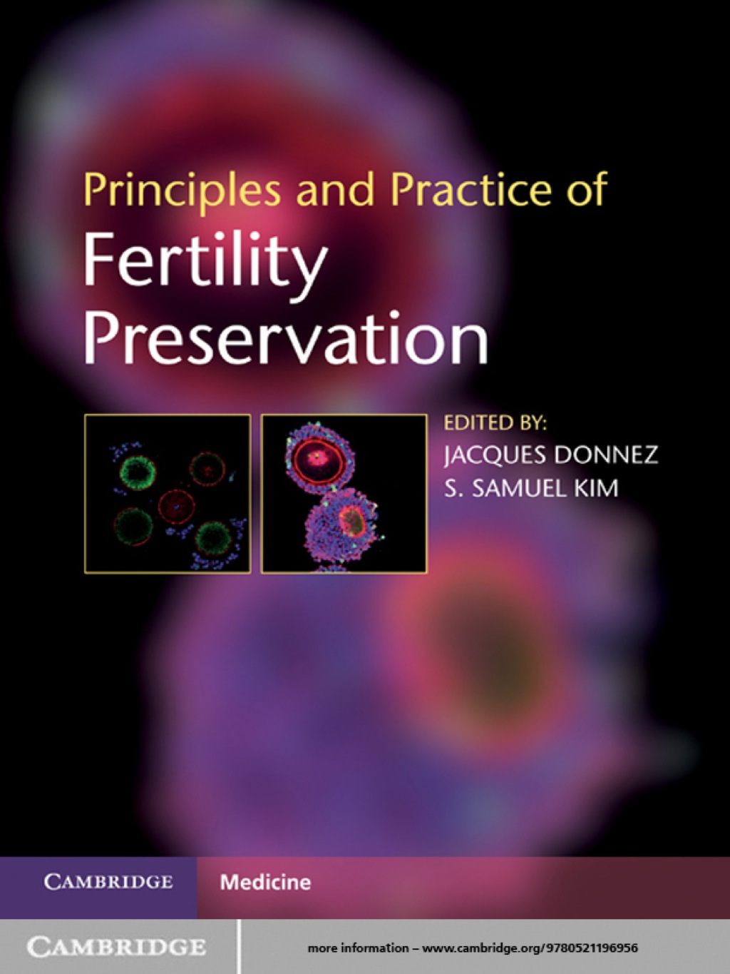 Principles and Practice of Fertility Preservation 1st Edition â€“ PDF/EPUB Version Downloadable