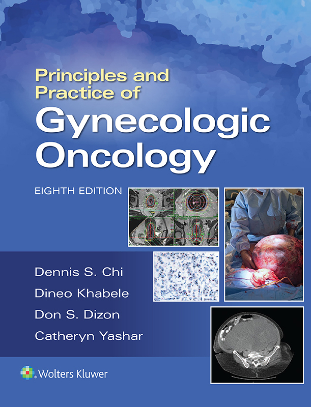 Principles and Practice of Gynecologic Oncology 8th Edition â€“ PDF/EPUB Version Downloadable