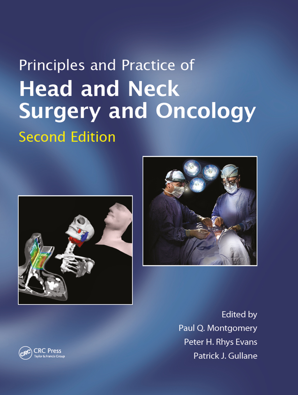 Principles and Practice of Head and Neck Surgery and Oncology 2nd Edition â€“ PDF/EPUB Version Downloadable