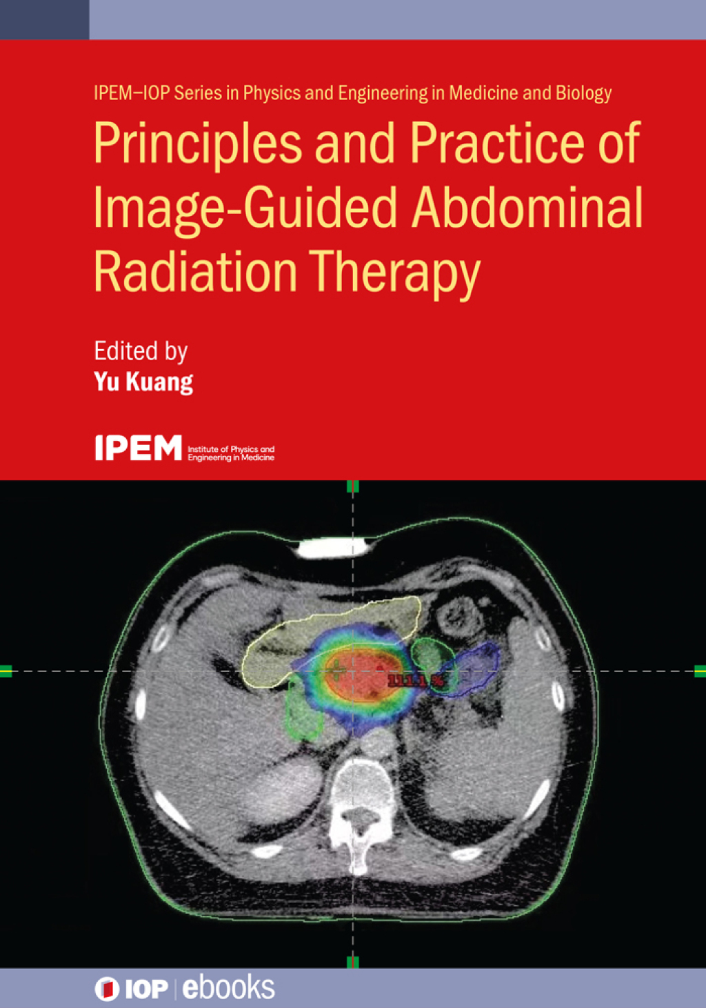 Principles and Practice of Image-Guided Abdominal Radiation Therapy  â€“ PDF/EPUB Version Downloadable