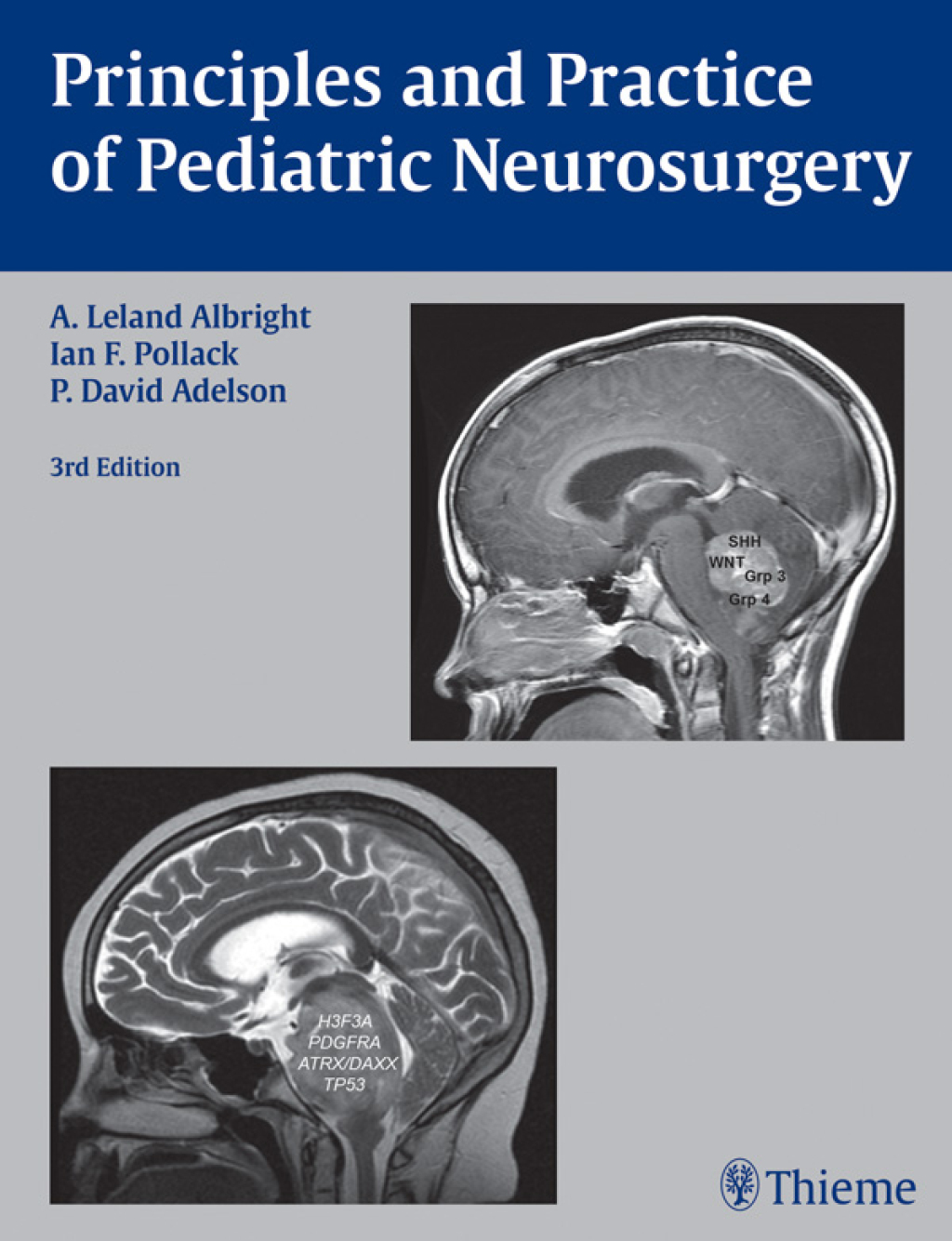 Principles and Practice of Pediatric Neurosurgery 3rd Edition â€“ PDF/EPUB Version Downloadable