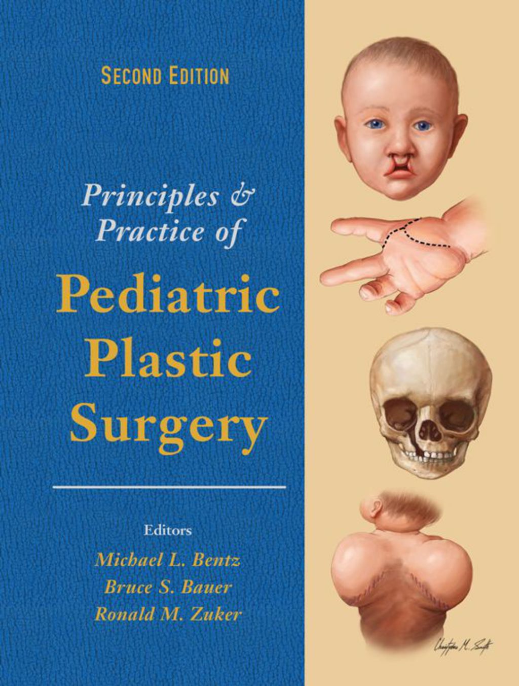 Principles and Practice of Pediatric Plastic Surgery - Two Volume Set 2nd Edition â€“ PDF/EPUB Version Downloadable