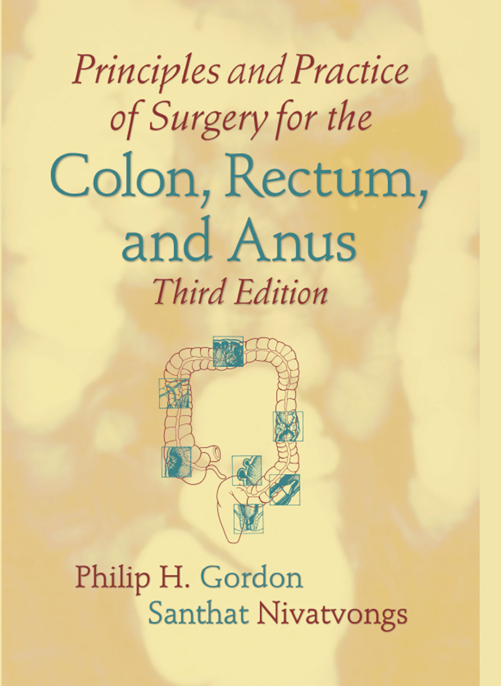 Principles and Practice of Surgery for the Colon, Rectum, and Anus 3rd Edition â€“ PDF/EPUB Version Downloadable
