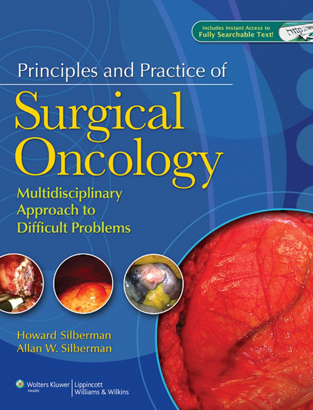 Principles and Practice of Surgical Oncology: A Multidisciplinary Approach to Difficult Problems 1st Edition â€“ PDF/EPUB Version Downloadable