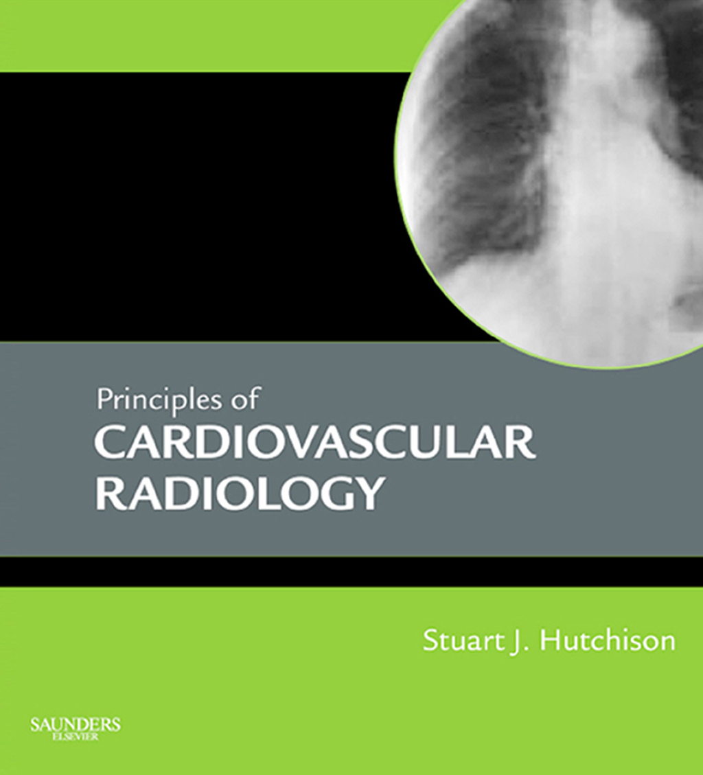 Principles of Cardiovascular Radiology 1st Edition â€“ PDF/EPUB Version Downloadable