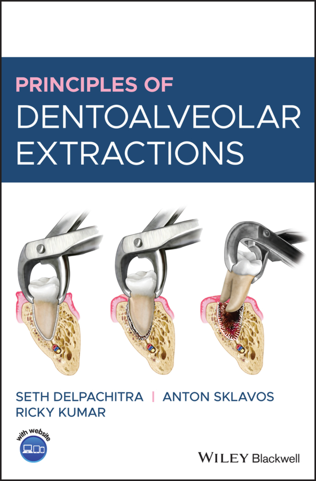 Principles of Dentoalveolar Extractions 1st Edition â€“ PDF/EPUB Version Downloadable