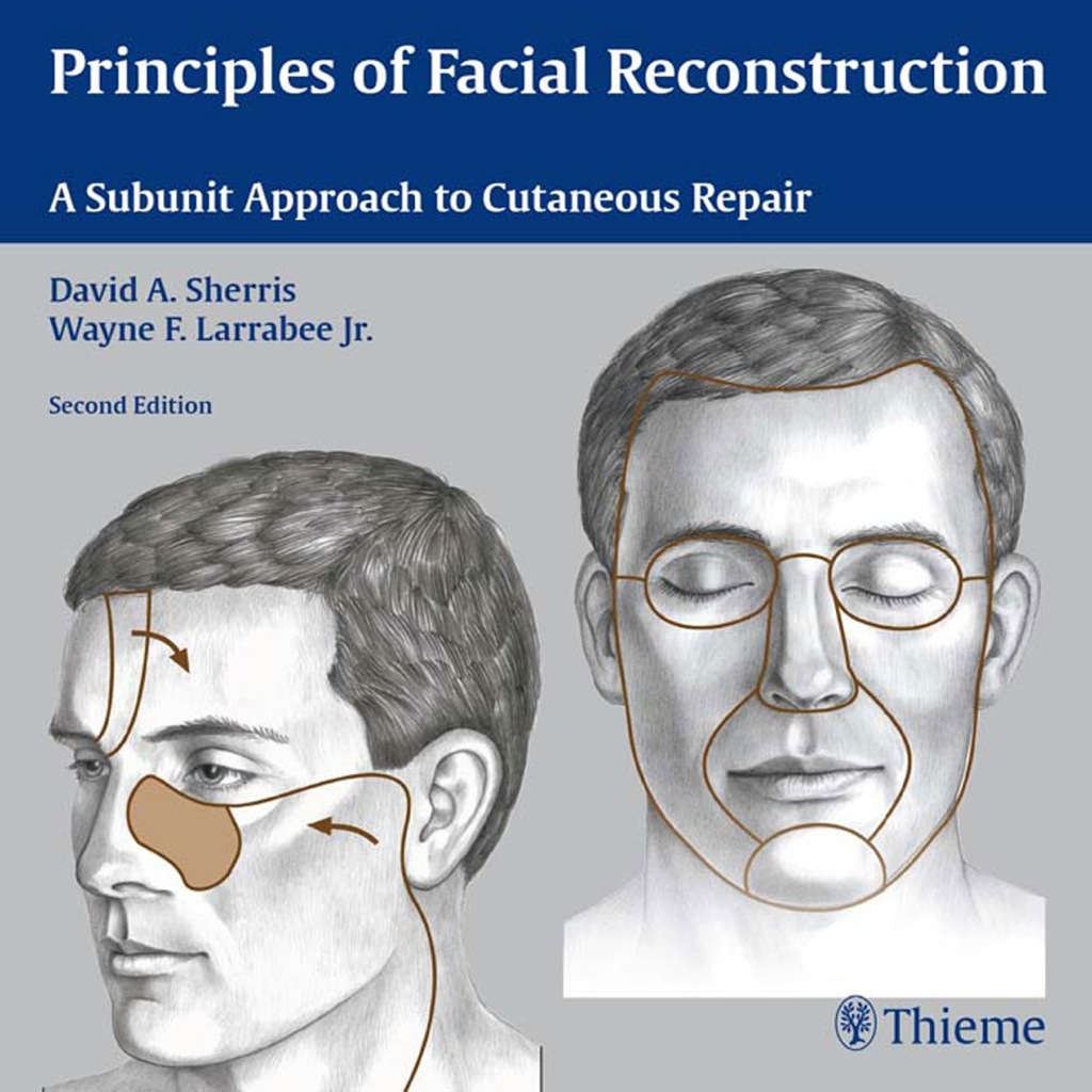 Principles of Facial Reconstruction A Subunit Approach to Cutaneous Repair 2nd Edition â€“ PDF/EPUB Version Downloadable
